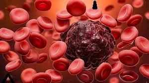 Blood Cancer Kills Fast, If You Want To Live Long, Stop Taking These 5 Things In Excess.